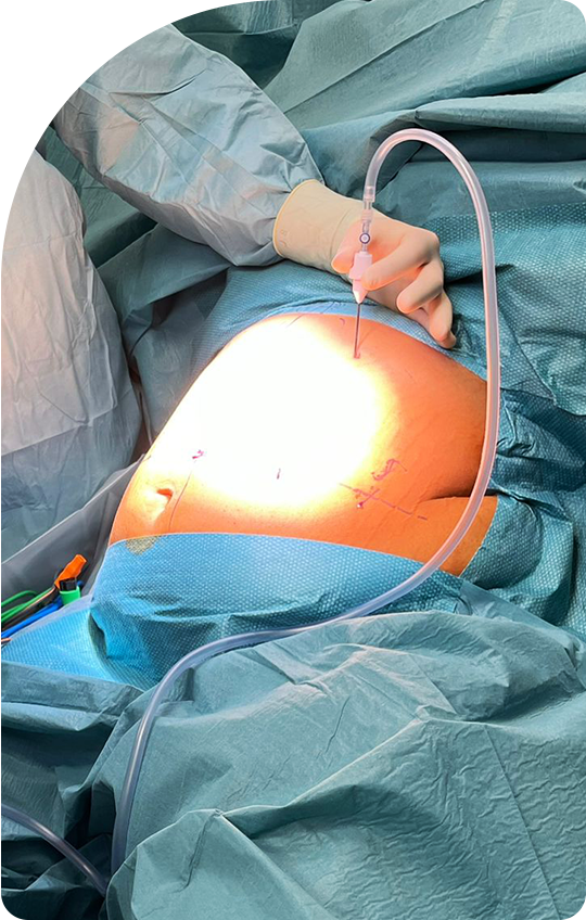 Dr. Sherif Akram Metwalli - Consultant Robotic and Visceral Surgeon at Klinikum Bielefeld Germany