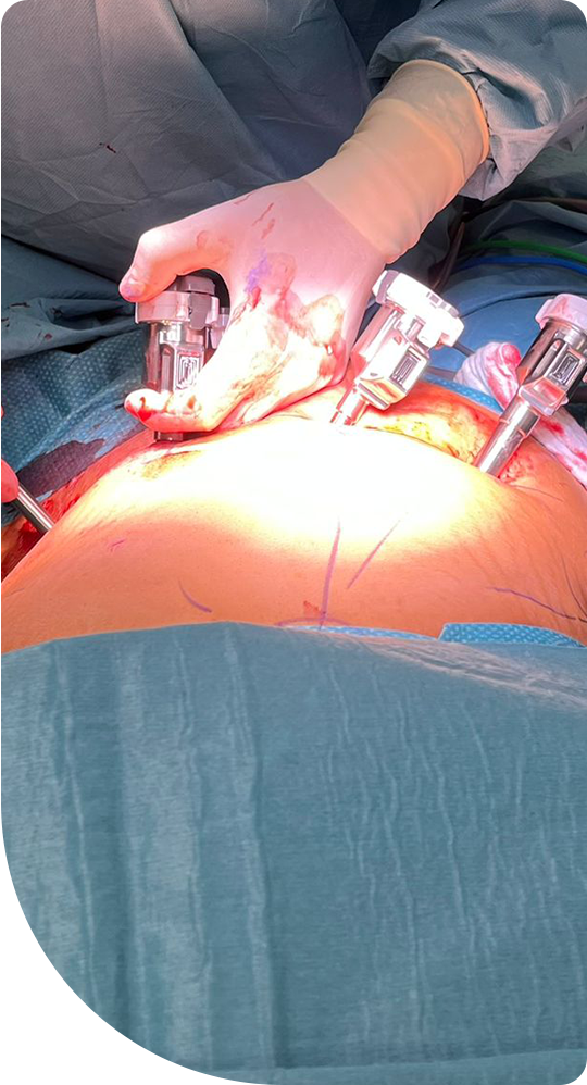 Dr. Sherif Akram Metwalli - Consultant Robotic and Visceral Surgeon at Klinikum Bielefeld Germany